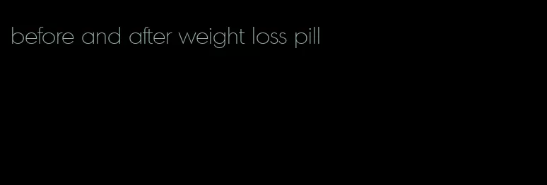 before and after weight loss pill