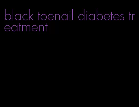 black toenail diabetes treatment
