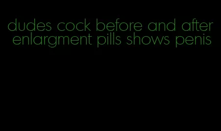 dudes cock before and after enlargment pills shows penis